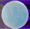 Fig 5 Bactéries transformées fluorescentes sous UV